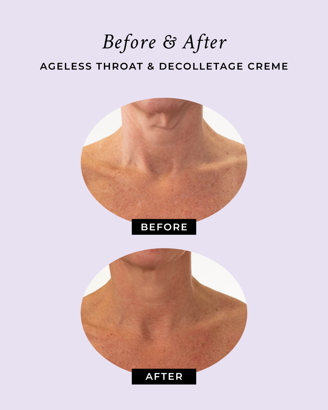 Ageless Throat & Decolletage Anti-Aging Neck Creme