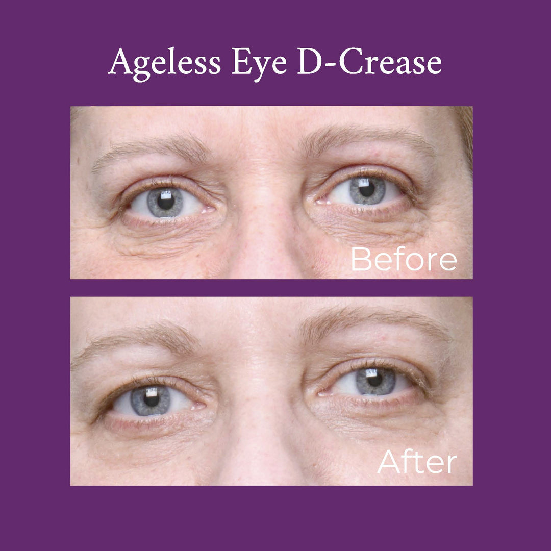 Ageless Eye D-Crease